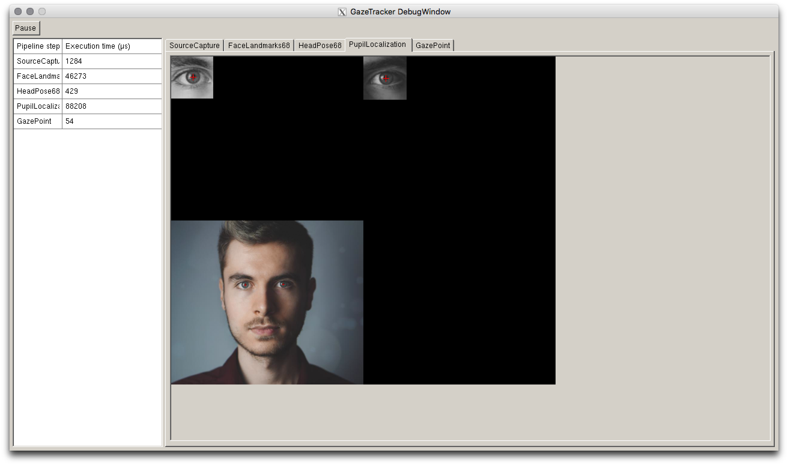 A GUI with a central area in which a picture of a man is rendered. The GUI also features smaller images of the eyes with marked pupils.